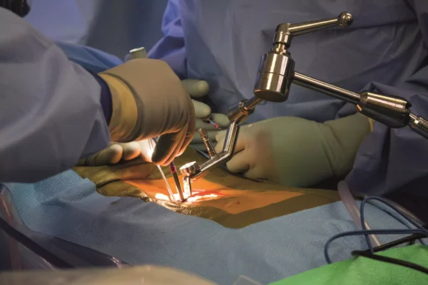 Spine Surgery